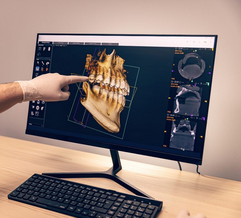 Imagerie radiologique dentaire Promax 3D Imagerie radiologique dentaire Promax 3D Une révolution dans les soins dentaires