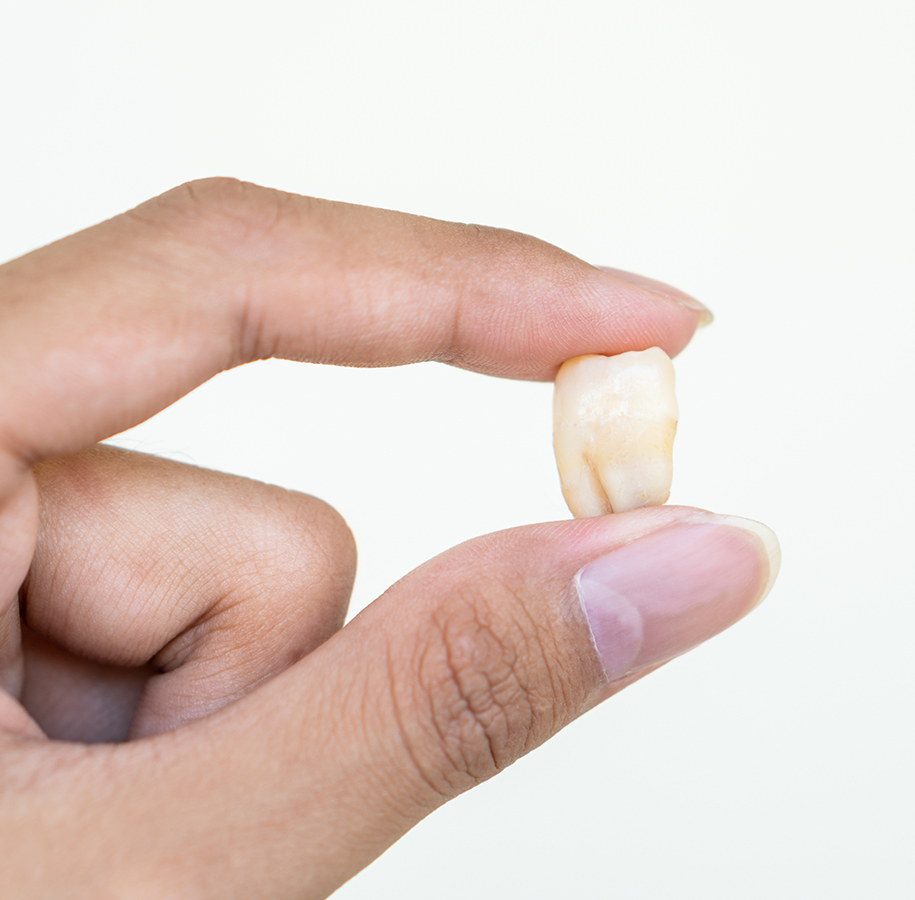 LES DENTS DE SAGESSE ET LEURS CAS PROBLÉMATIQUES LES DENTS DE SAGESSE ET LEURS CAS PROBLÉMATIQUES