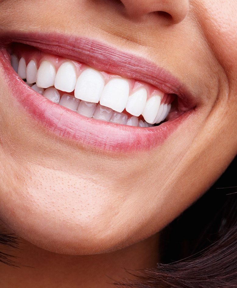 La dentisterie esthétique : un choix judicieux offrant de nombreux avantages La dentisterie esthétique : un choix judicieux offrant de nombreux avantages